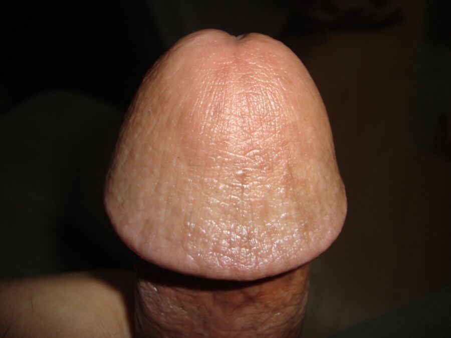 My Circumcised Cock