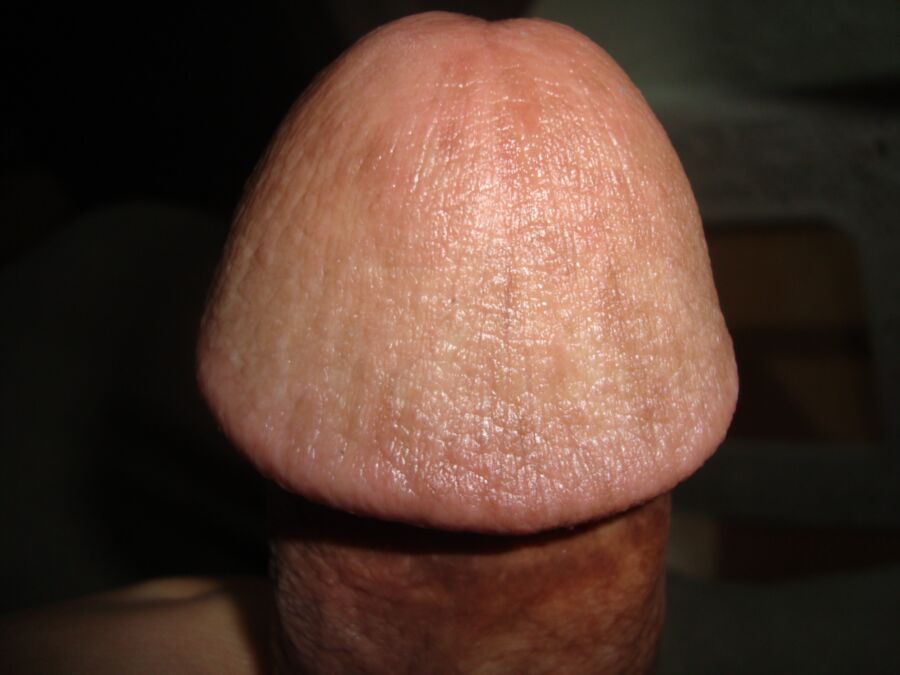 My Circumcised Cock