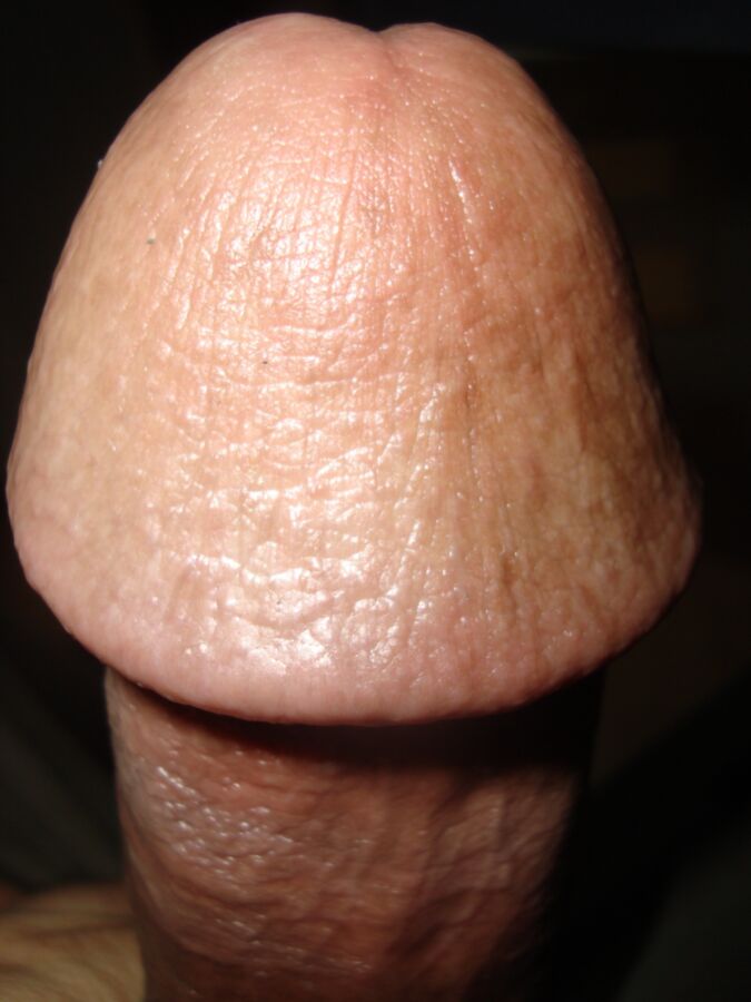 My Circumcised Cock