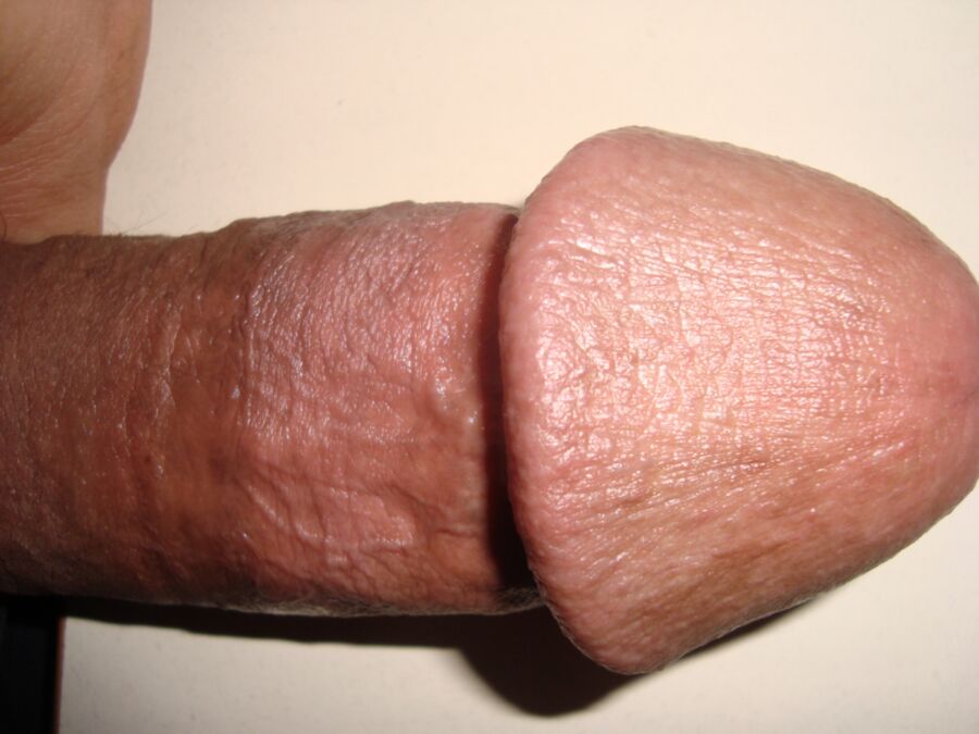 My Circumcised Cock