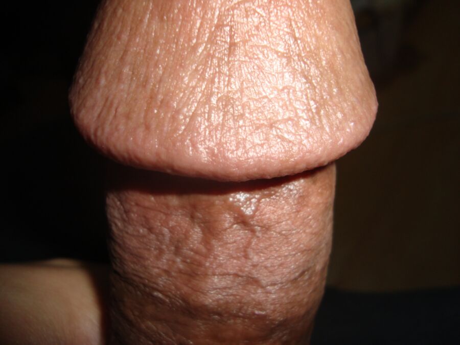 My Circumcised Cock