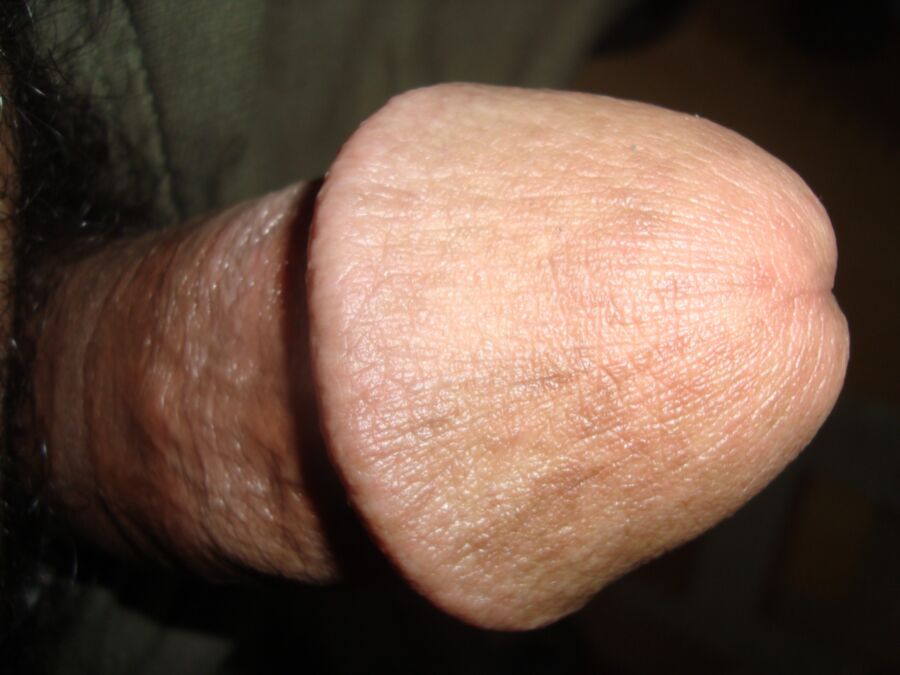 My Circumcised Cock