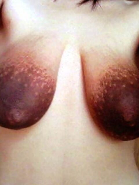 tetas feas