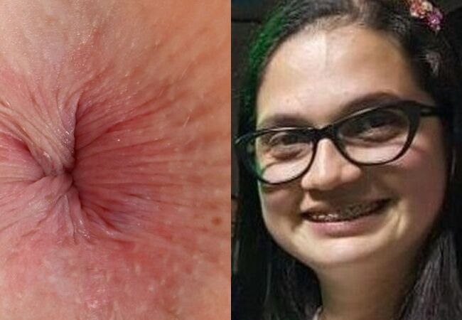 Face and Anus Hot Amateur