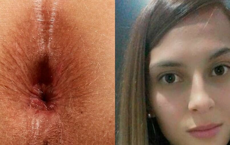 Face and Anus Hot Amateur