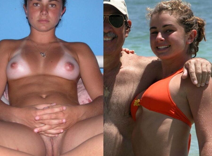 Tanline adolescente