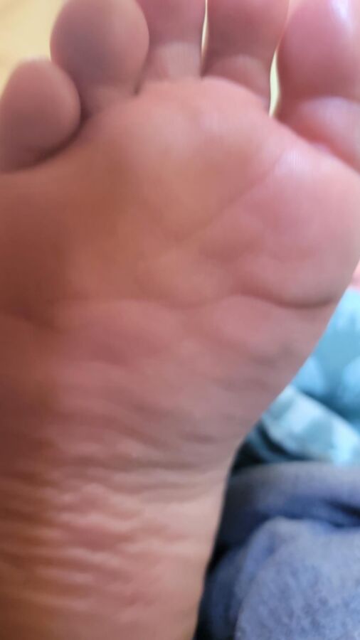 Grace Has Fat Feet And Toes