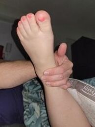 Grace Has Fat Feet And Toes