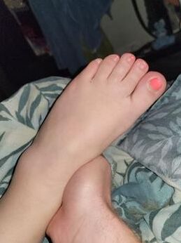 Grace Has Fat Feet And Toes