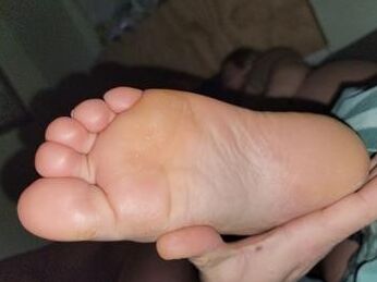 Grace Has Fat Feet And Toes