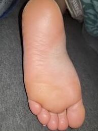 Grace Has Fat Feet And Toes