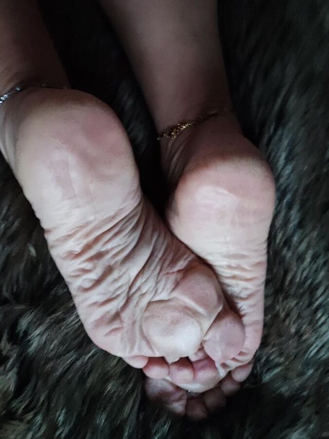 Hot Feet and Soles