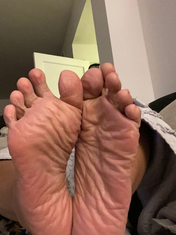 Hot Feet and Soles