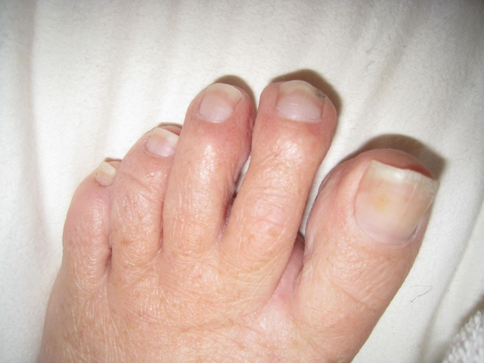 Elaine's Size / Feet and Red Pubic Hair
