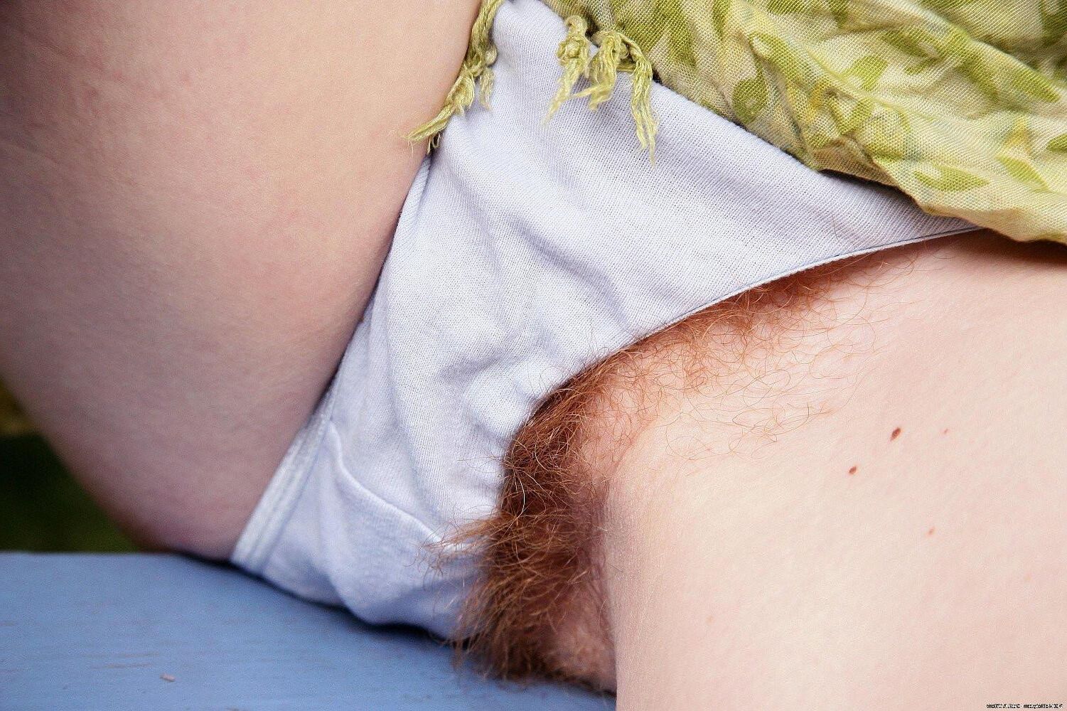 Redhead
