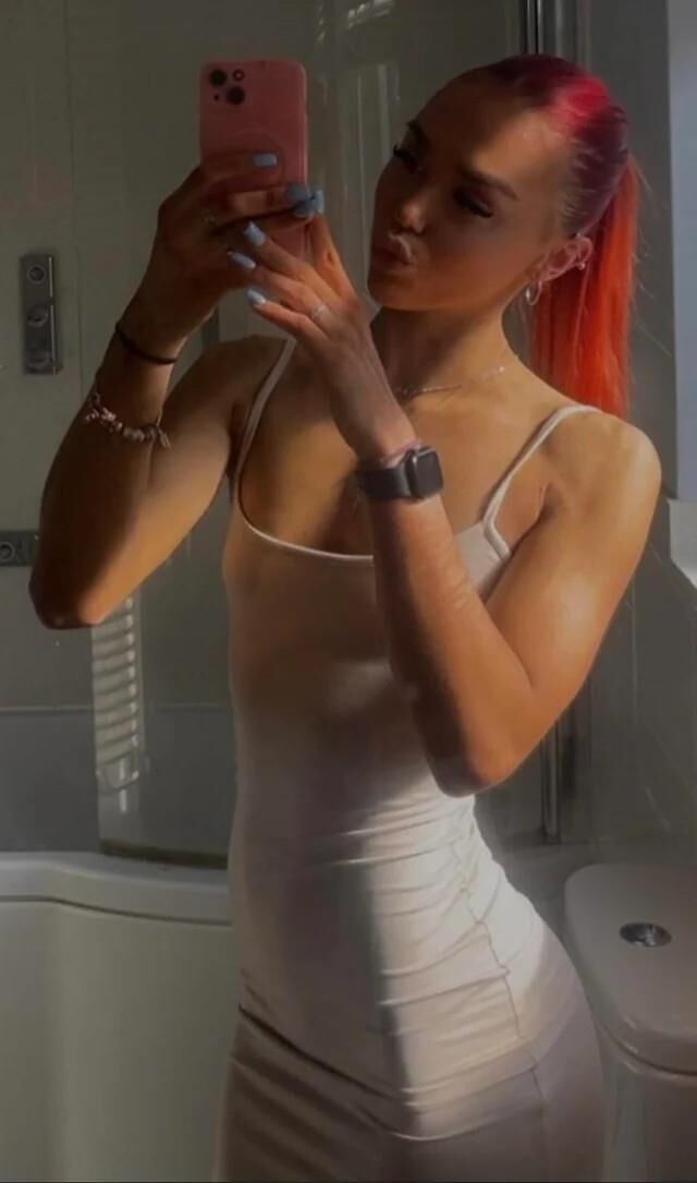 Redhead's 